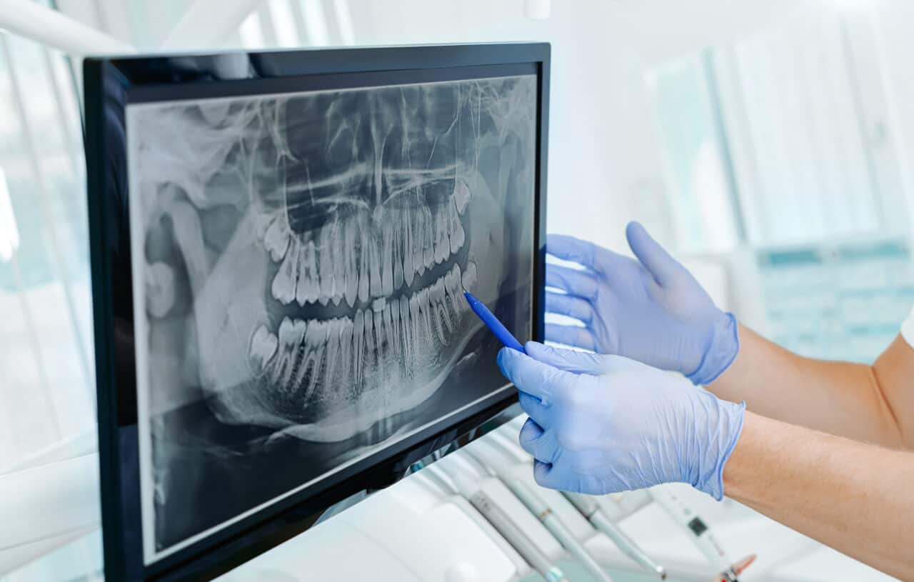 Close-up of dental professional examining a digital X-ray on a monitor, highlighting advanced dental technology for diagnostics and patient care.